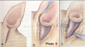 Chirurgie de l<span data-charcode=