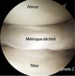 Déchirure des ménisques du chien Neuilly-sur-Seine, Paris